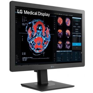 LG 24” 2MP IPS Clinical Review Monitor - 24HR513C-B